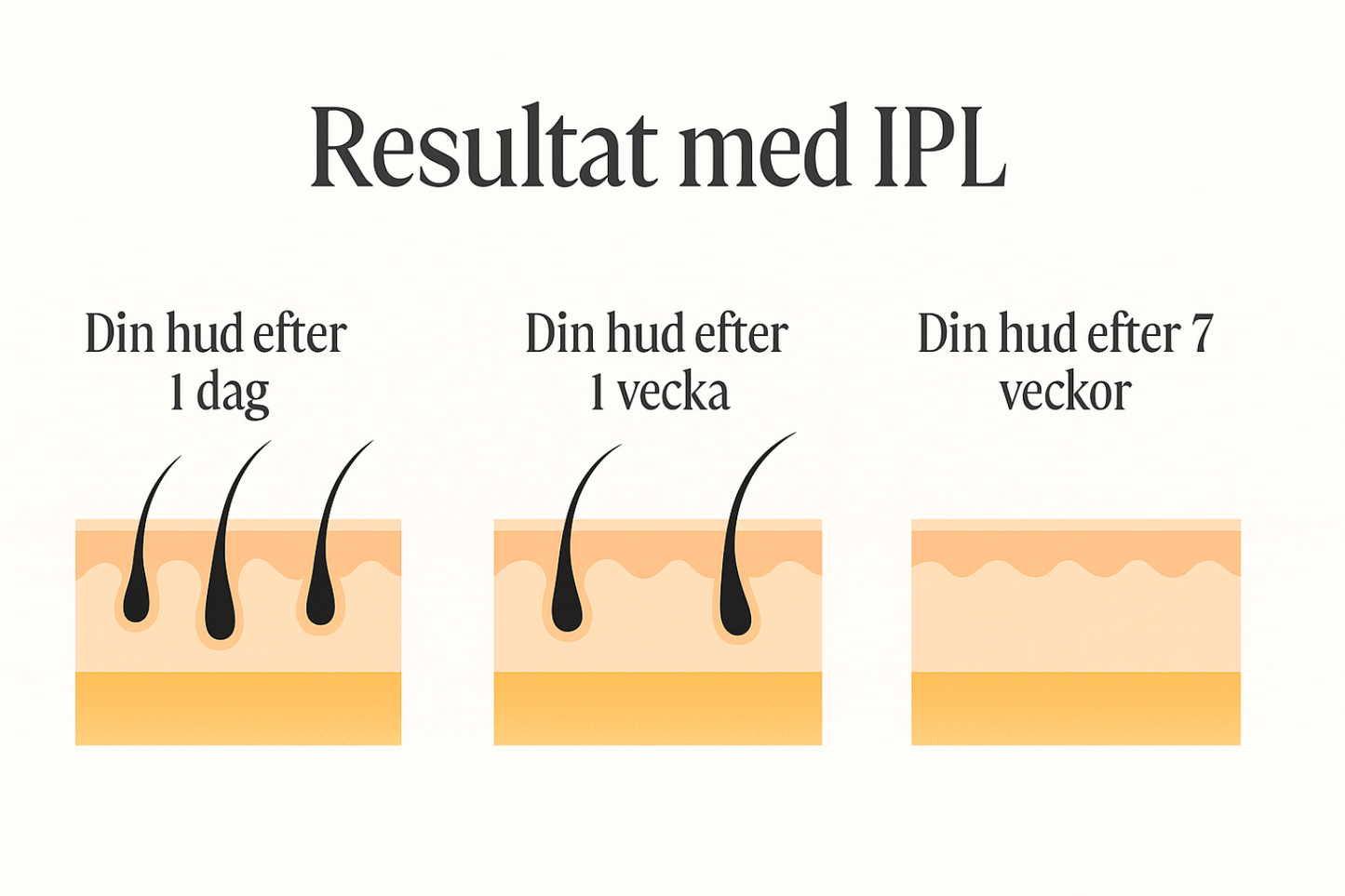 Avlson LUMI IPL hårborttagningsapparat