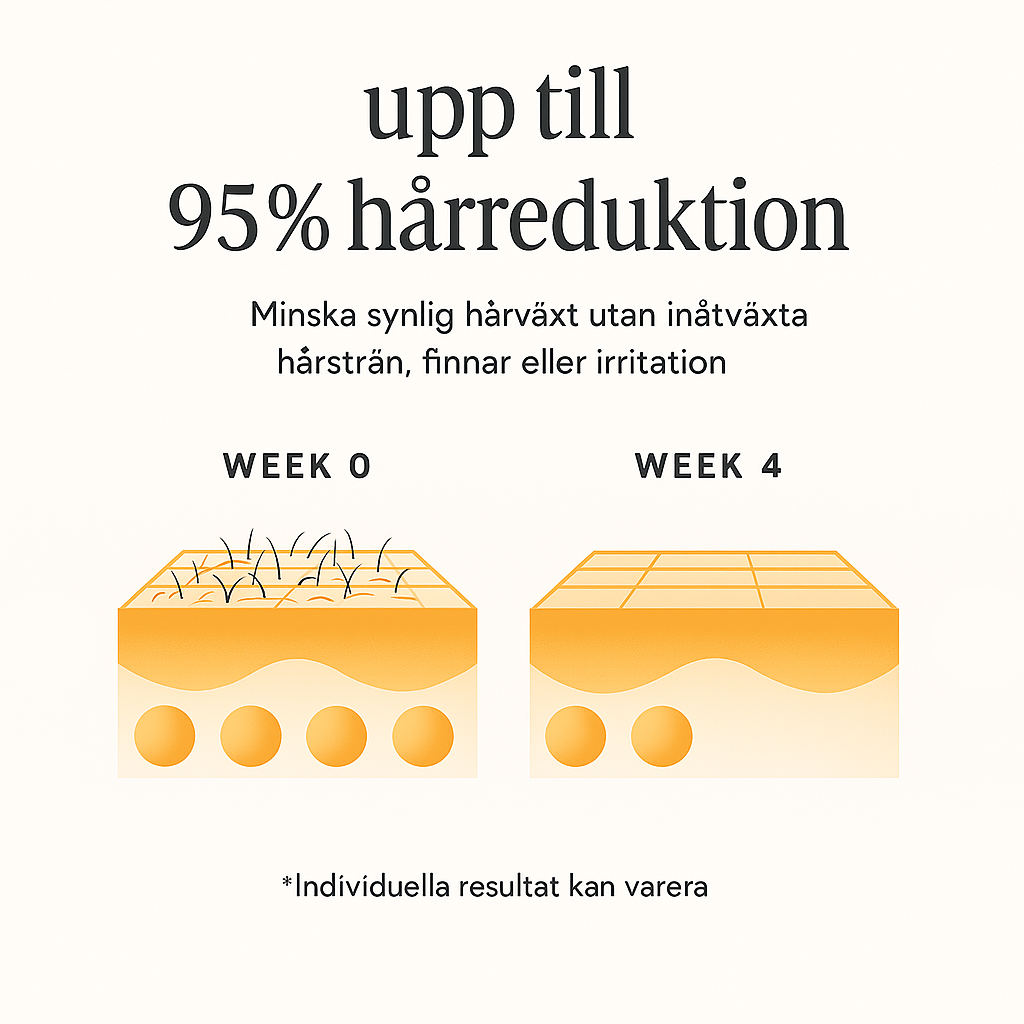 Avlson LUMI IPL hårborttagningsapparat